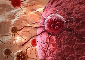 En este momento estás viendo Tratar el cáncer de colon «matando de hambre» a las células tumorales